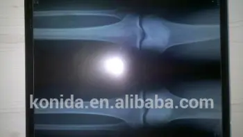 agfa xray film agfa drystar printer agfa printing sandvich new products