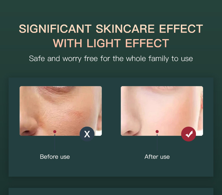 red and blue light therapy