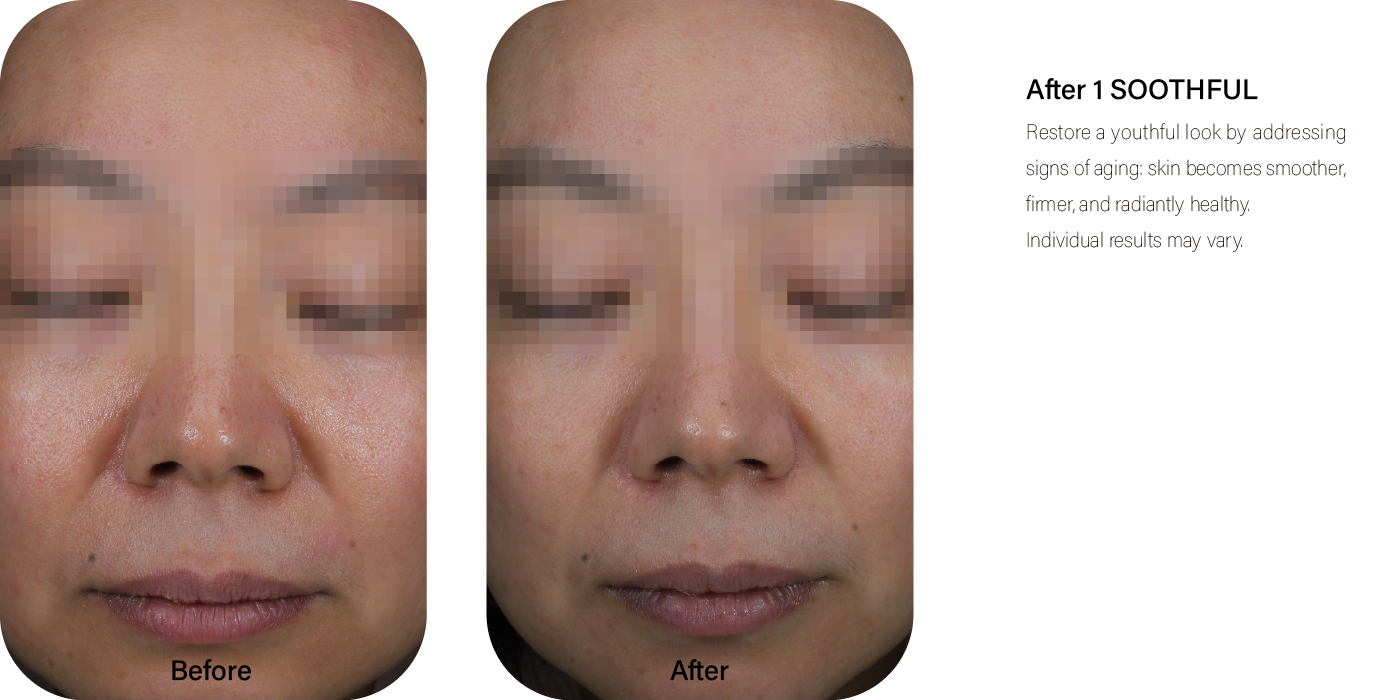 شيخوخة الجلد