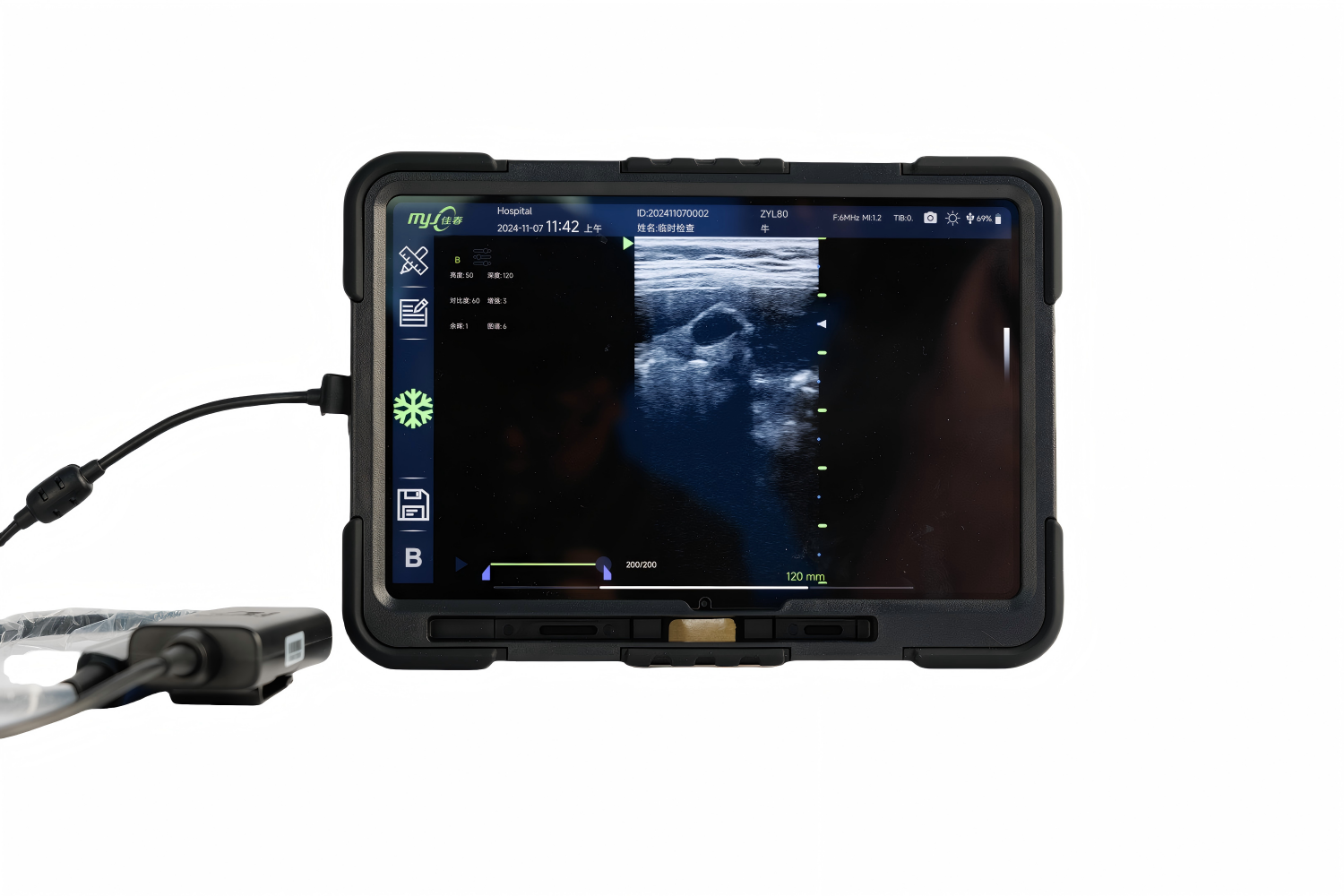 pregnant mare ultrasound
