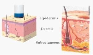 Art Rf Technology Anti-aging Machine For Face Lifting