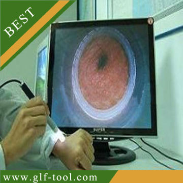 BEST-USB digital dermatologist magnifying glass