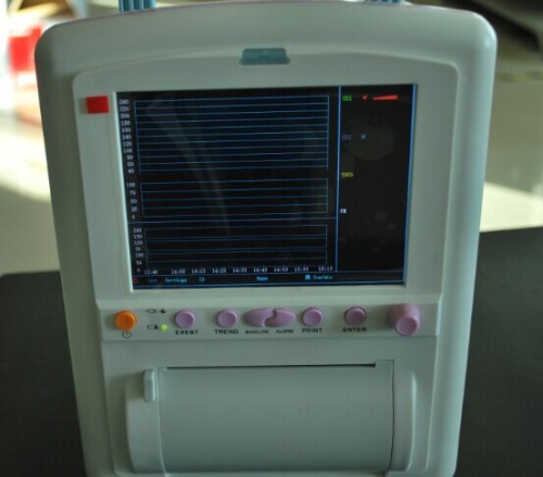 Fetal Monitor M1720A