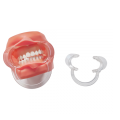 Retractor de mejillas para blanquear los dientes de labios dentales en forma de C