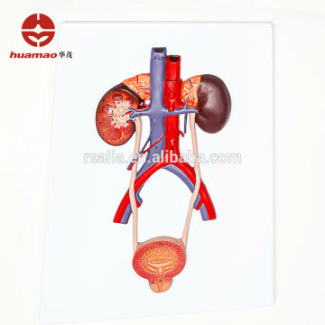 HM-BD-068 Ningbo Huamao Plastic Urinary system model Urinary system anatomy model Urinary system anatomical model