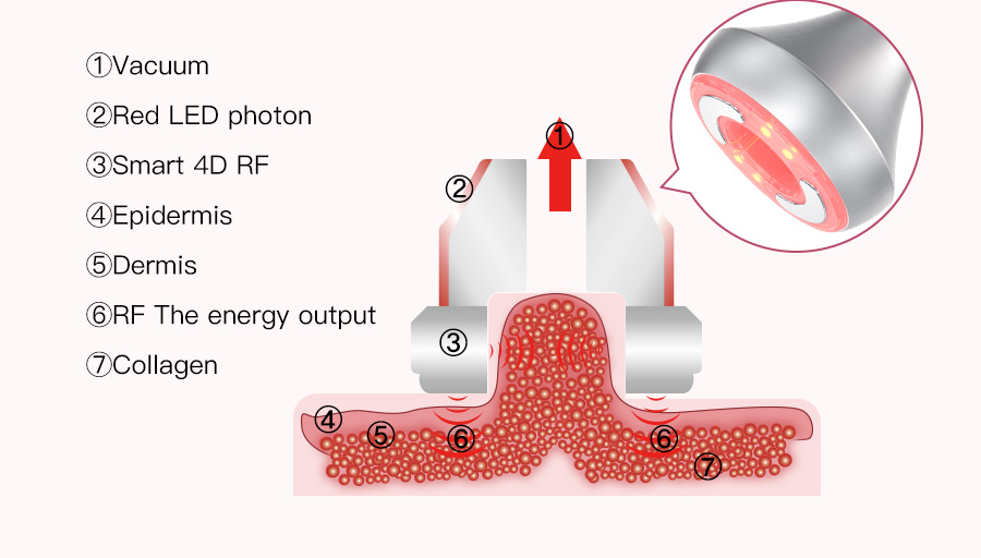 cavitation vacuum