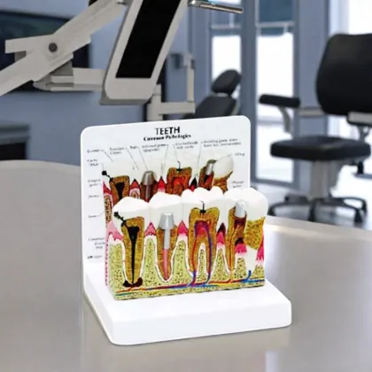 DARHMMY Medical Science Dental Pathology Models and Teaching Aids