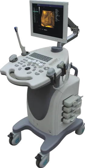 Color Doppler Ultrasound Diagnostic System Trolley
