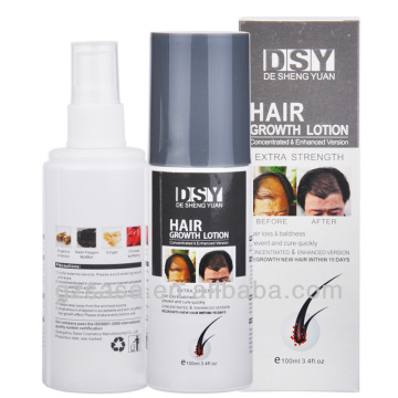 best hair loss products DSY 100ML treatment for hair loss