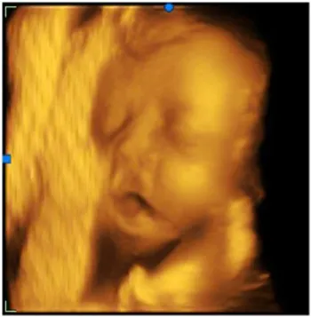 Laptop Full digital equipo de ultrasonido 4d sonography echographe portable