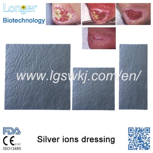 Hangzhou Alibaba China Silver Ion Sterile Dressings