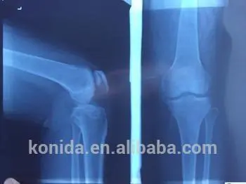 new products medical dry film medical film konica film