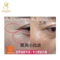 Sterile Ampoule Gene Peptide Allsensa Dark Circle Solution Eye Bag Wrinkle Removal