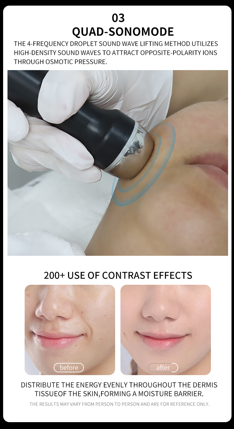Professional skin tightening machine