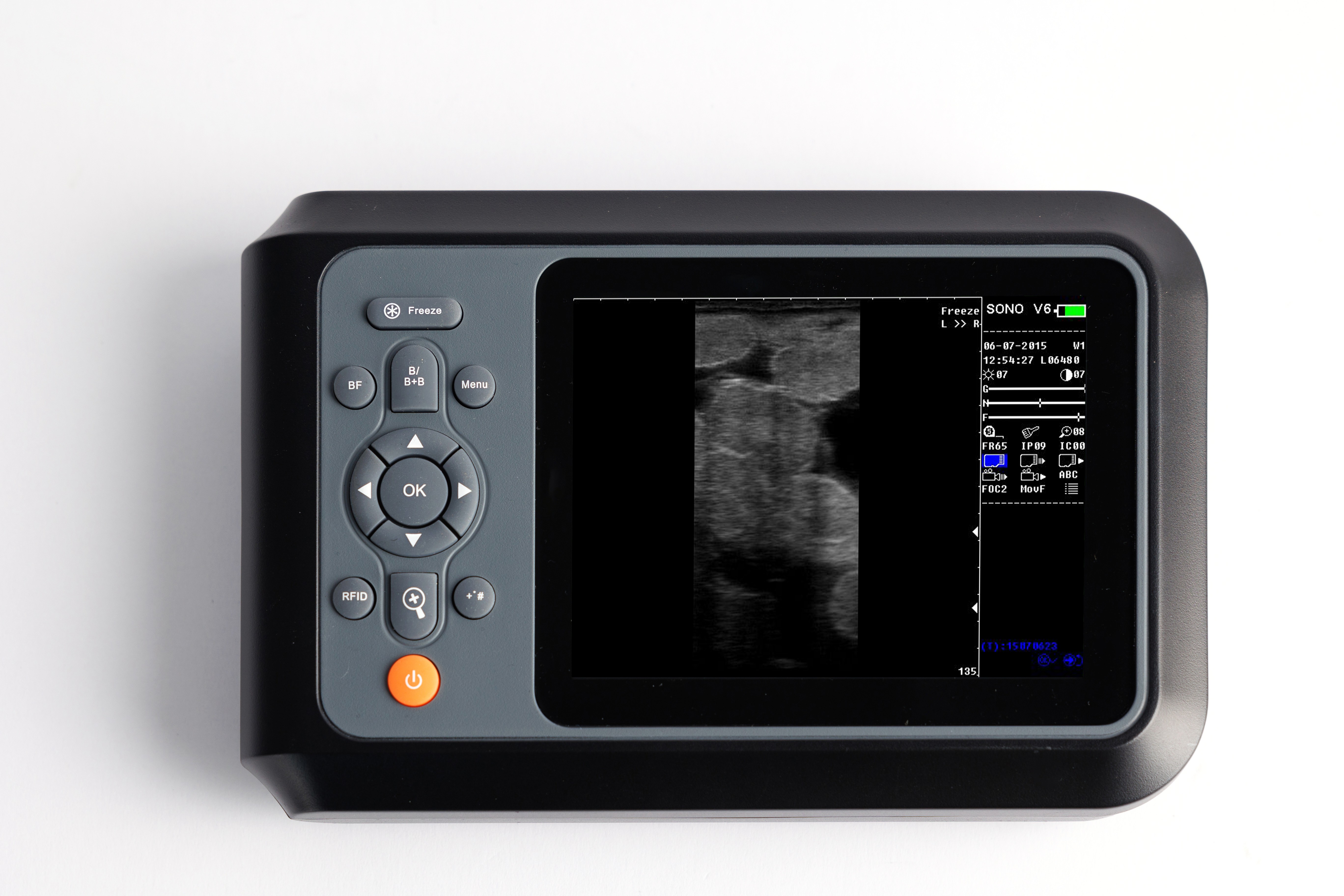 veterinary ultrasound for sale
