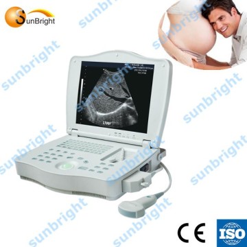 Fetal health care Pregnancy testing equipment ultrasound scanner