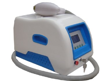 Q-Switch nd yag laser tattoo removal