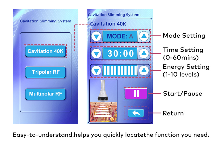 cavitation machine 40k