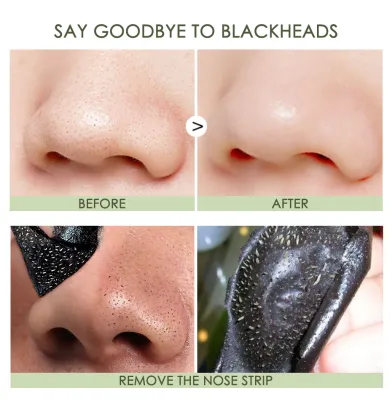 Pore Cleaning Blackhead Removal Stickers