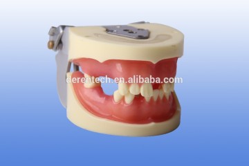 dental implant model , transpartnet dental implant model ,implant dental model