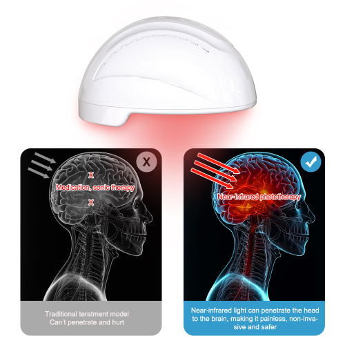810nm Infrared Light Therapy Helmet for Alzheimer's