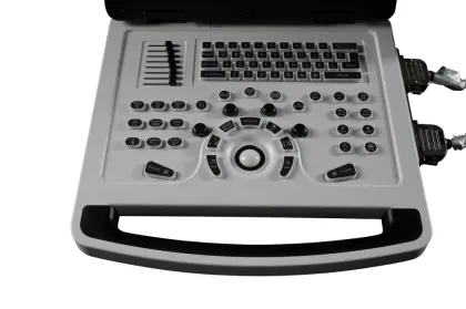 B/W ultrasound machine Notebook B Ultrasound Scanner
