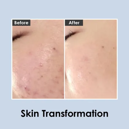 Wholesale Centella Mezzo Cream: MEDI-PEEL's 30ml Skin Care Solution