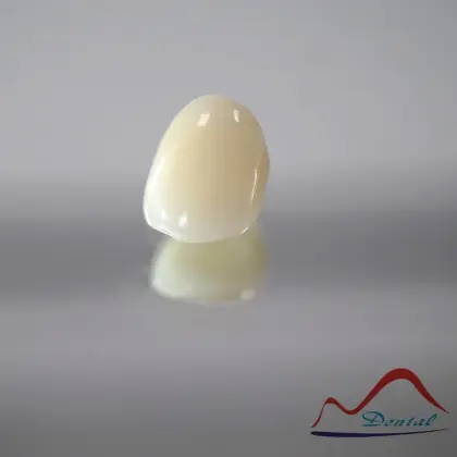 Dental Anterior Zirconia Restoration
