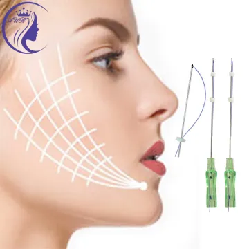 Face Lift Pdo Threads Cog Lifting Suture