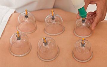 Vacuum Cupping massage cup