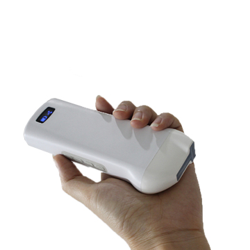 T Wireless Ultrasound Vascular Crosscut & longitudinal Probe