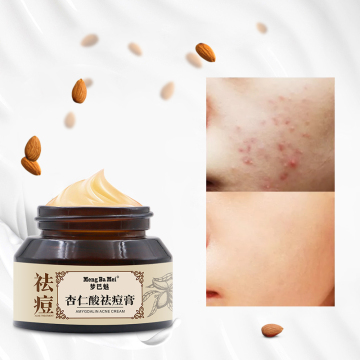 Acne Removal Cream Strong Effect Whitening Facial Cream