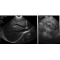 UPROBE-C5M SONOSTAR Tragbare Ultraschallmaschine