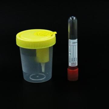 Siny Medical Supply Hospital Steriler Urinbehälter