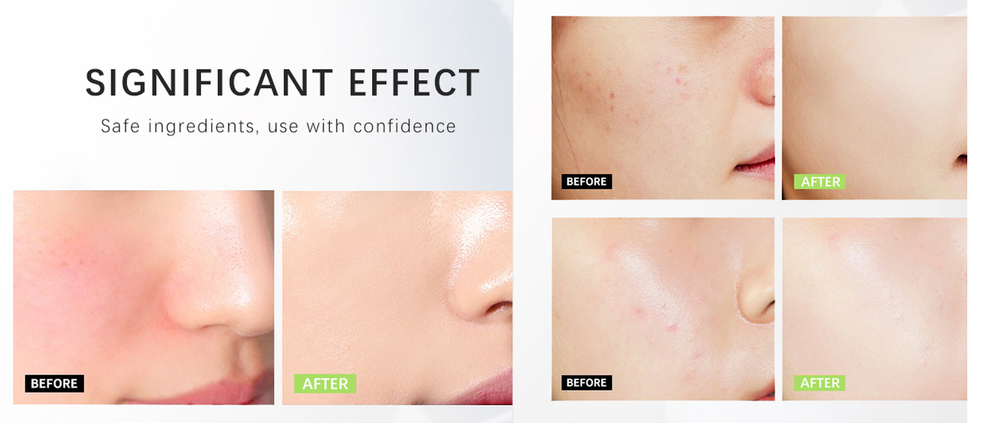 Siero di squalane Squalane serum
