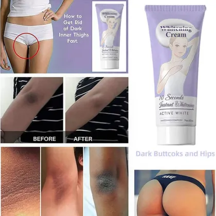 OEM Private Label Acne and Dark Spot Removal Face Cream