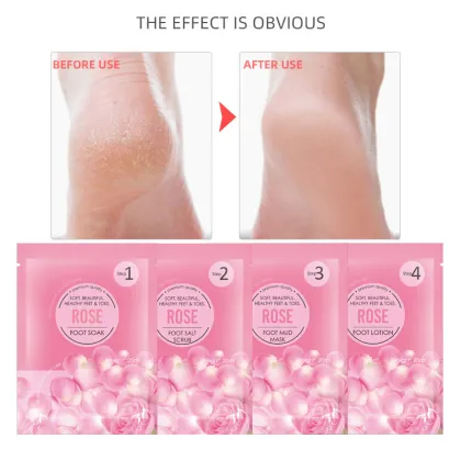 Wholesale Foot Care: 4 Piece Set - Soak Herbs & Repair Cream