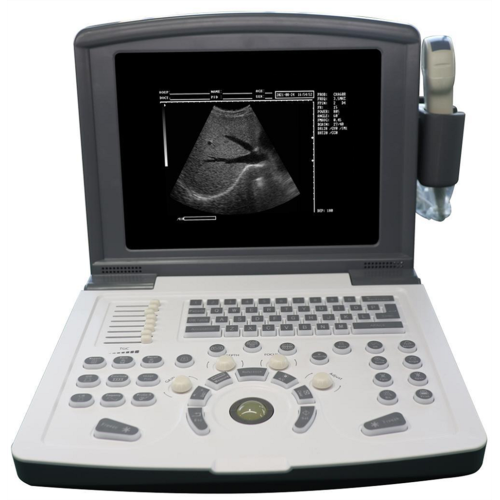 Hot Sale MDK-660A Portable B-Ultrasound Machine