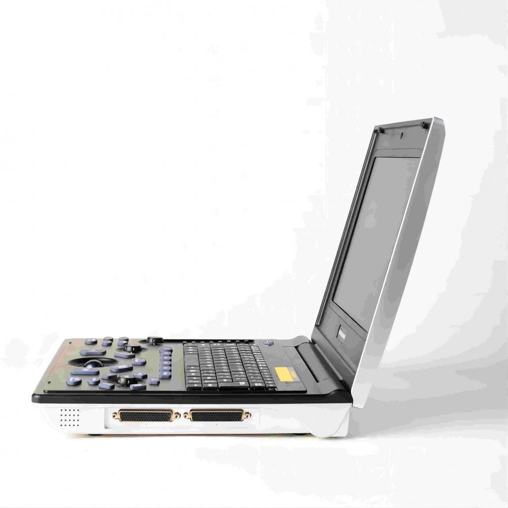 Жаночыя камяні ўльтрагукавога дыягностыкі