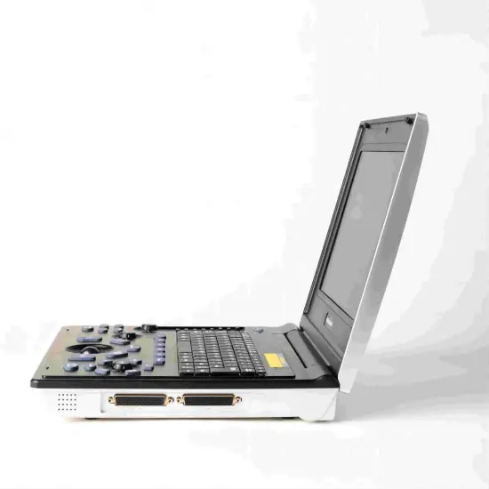 Female gallstones ultrasound diagnosis instrument