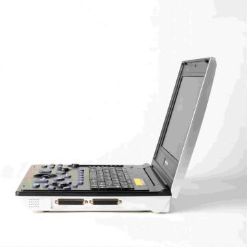 Жаночыя камяні ўльтрагукавога дыягностыкі