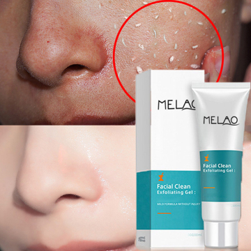 Whitening Aloe Vera Exfoliant Gel Facial Wash Cleanser