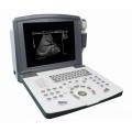 China Portable Black &white Ultrasound scanner(battery) Supplier