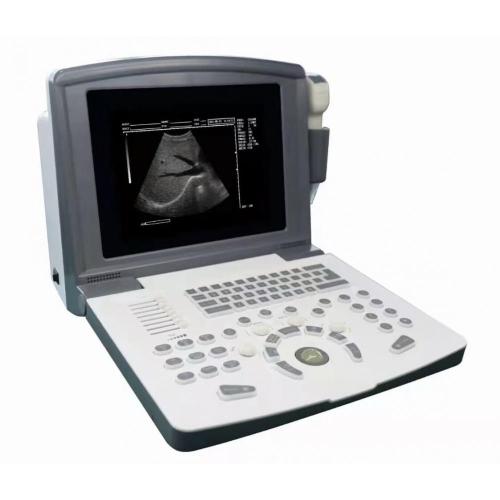 China Portable Black &white Ultrasound scanner(battery) Supplier