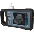 New Handheld Full-digital Ultrasound Scanner