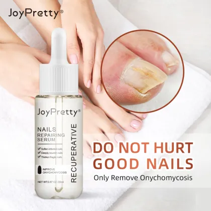 Foot Fungus Treatment: Antifungal Agents & Nail Care Solutions