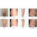 CHOUCY CAVITATION RF Slimming System