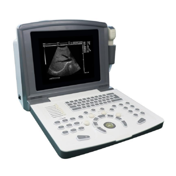 Portable B-Ultrasound Scanner for Cardiovascular