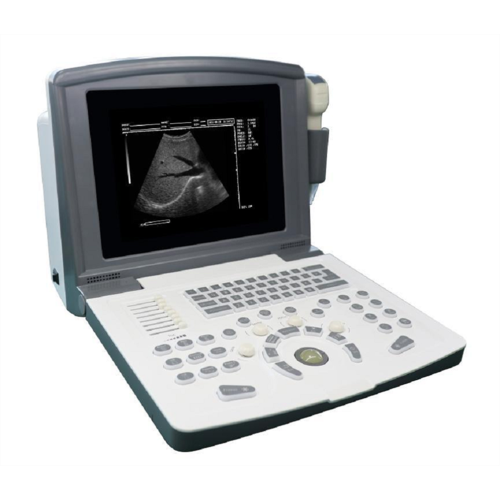 Portable B-Ultrasound Scanner for Cardiovascular