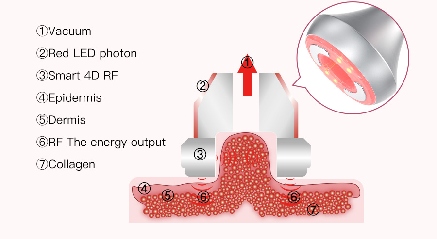 Body Sculpting Machine11